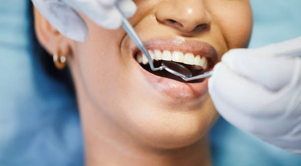 Best Tooth Infection Emergency Dentist  in Truckee, CA
