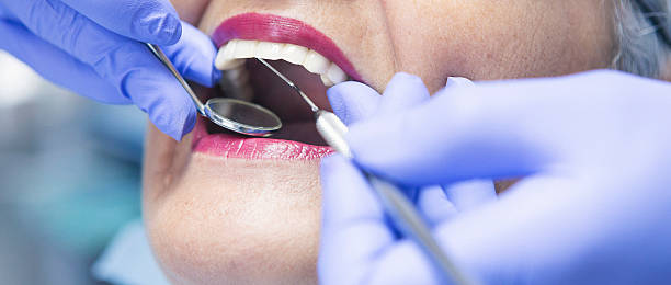 Best Knocked-Out Tooth Emergency  in Truckee, CA